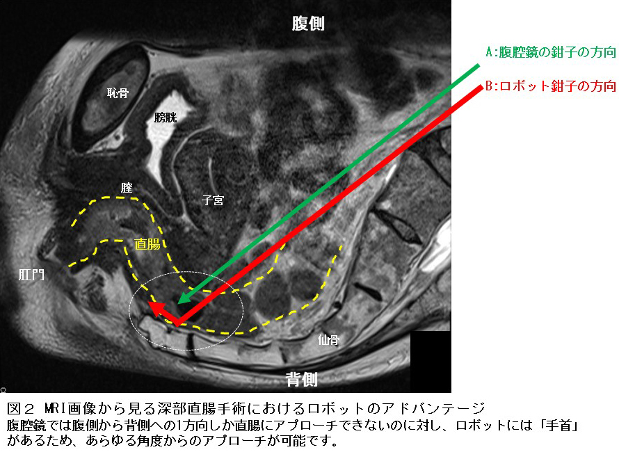 図2