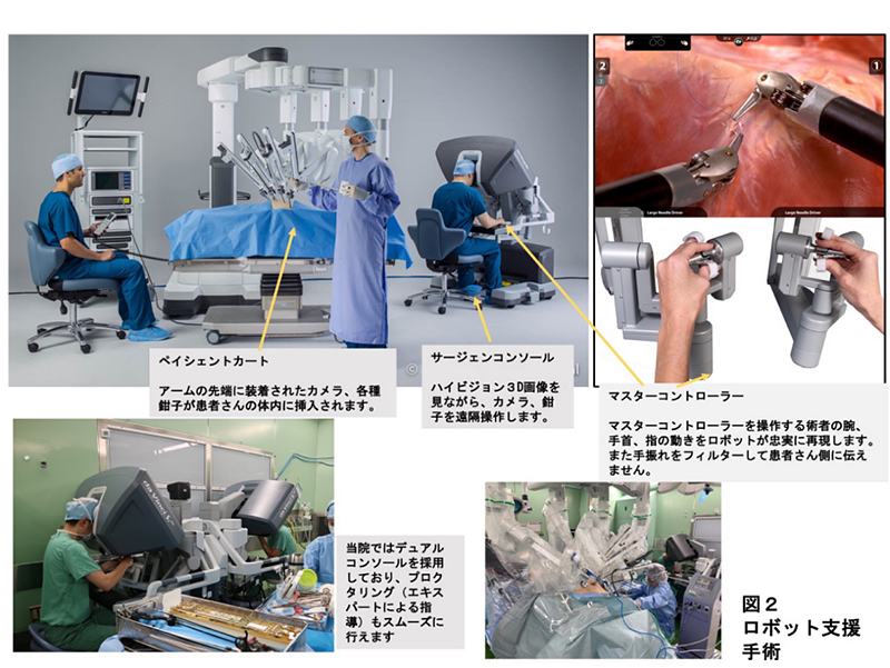 ロボット支援手術