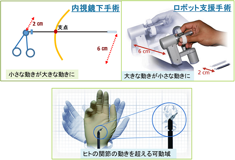 繊細な鉗子操作